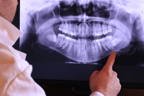 Best Emergency Dentist for Knocked-Out Tooth in West Reading, PA
